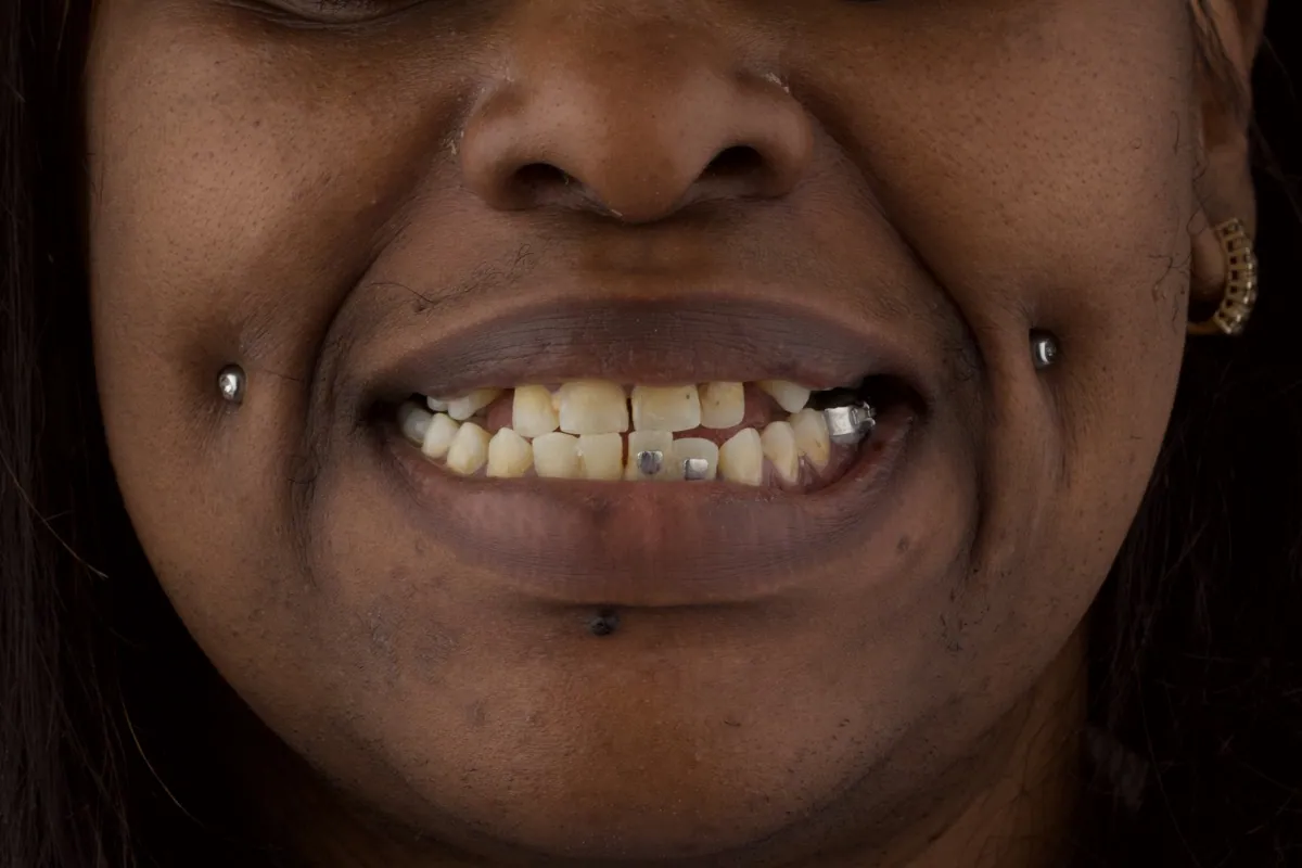 Smile before dental treatment